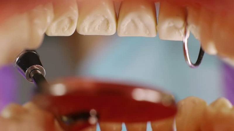 بیماری پریودنتال و اهمیت بهداشت دهان و دندان