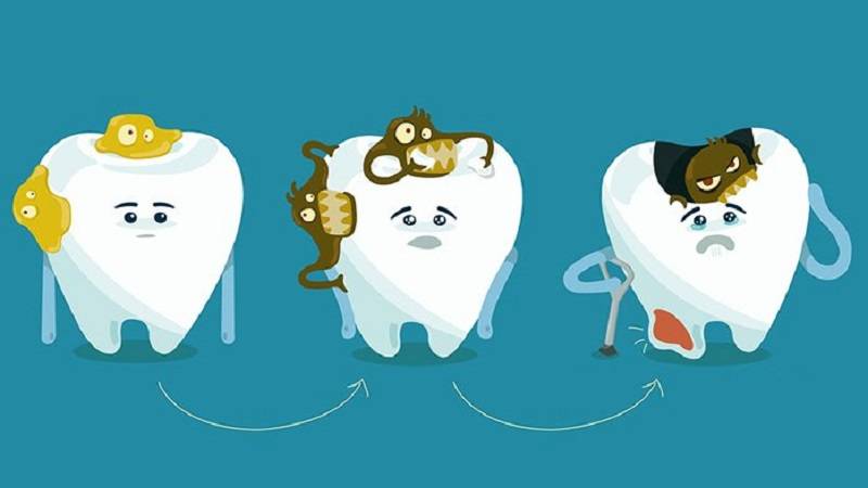 آشنایی با روش های تشخیص ابتدایی پوسیدگی دندان