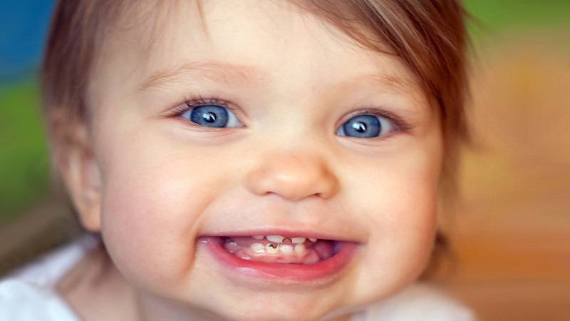 خمیر دندان زیاد باعث پوسیدگی دندان کودک می شود یا خیر؟