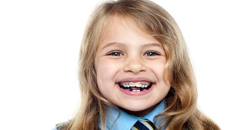 دندانپزشک کودکان اصفهان |چه تفاوتی میان ارتودنسی در کودکان با بزرگسالان است ؟