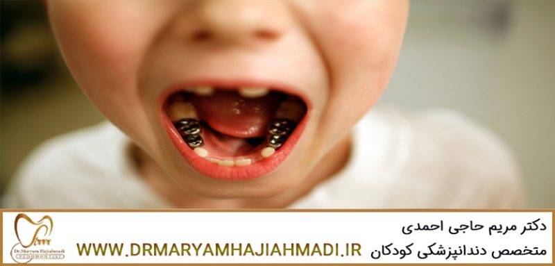 بهترین متخصص دندانپزشکی کودکان در اصفهان