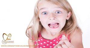 drmaryamhajiahmadi31 300x163 - سیلانت های دندانی چیست و چگونه می توانند از دندان های کودک من محافظت کنند؟