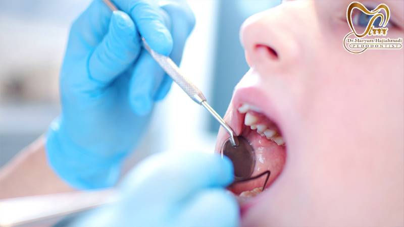 درمان پوسیدگی دندان کودکان
