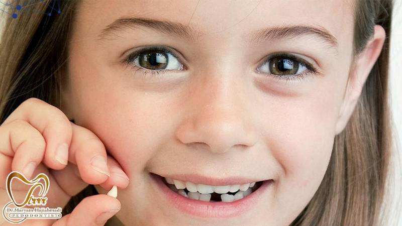 دندان های شیری - آنچه باید در مورد دندان های شیری بدانید؟