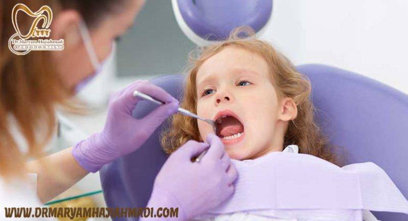 پرکننده های دندان کودکان1 scaled - انواع پرکننده های دندان مورد استفاده در کودکان