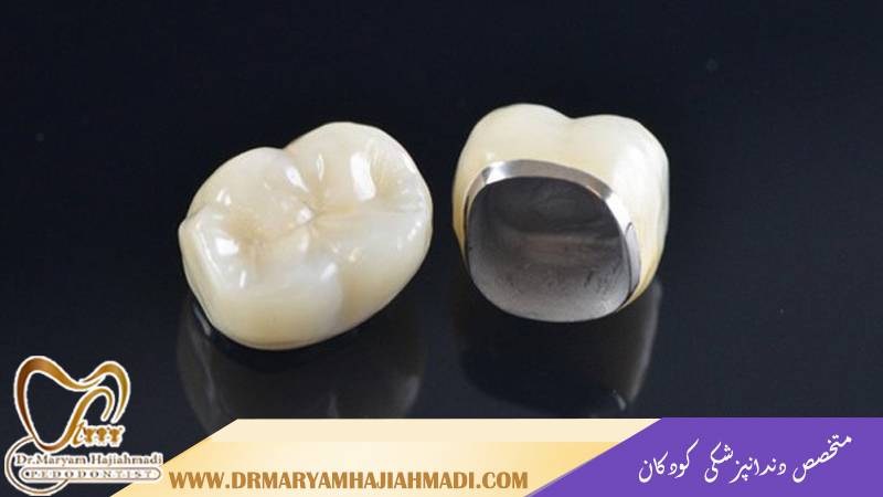متخصص دندانپزشکی کودکان اصفهان | دندانپزشکی کودکان تحت بیهوشی اصفهان