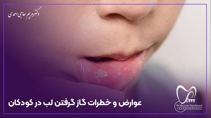عوارض و خطرات گاز گرفتن لب در کودکان