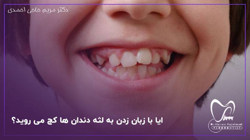 دندان های کج