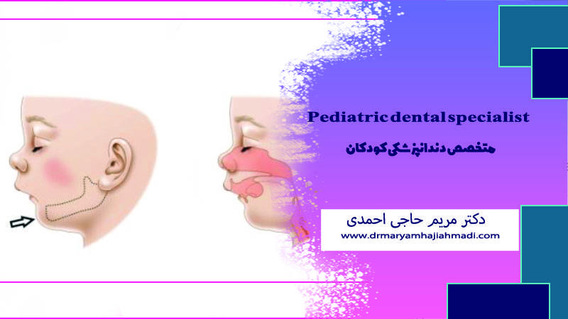 ناهنجاری‌های فک در کودکان